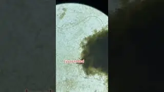Cell Explodes Under Microscope (Lysol Added) #microscope #science #microscopy