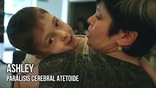 Ashley, Parálisis Cerebral Atetoide | Testimonio Tratamiento Células Madre