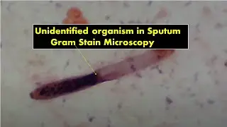 Unidentified organism