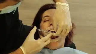 Colocação de Prótese Fixa superior sem Gengiva Artificial