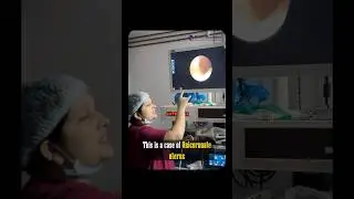 Rare Gynecology Case by Dr. Swapna Naik | Unicornuate Uterus & Rudimentary Horn