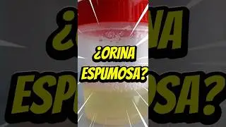 Orina espumosa: &iquest;normal o se&ntilde;al renal? #salud #ri&ntilde;on #bienestar #medicina