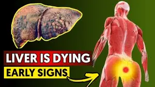 LIVER is DYING! 12 Weird Signs of LIVER DAMAGE (HealthEclipse)