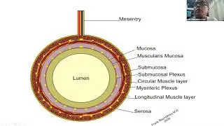 Obtruccion intestinal, An&aacute;lisis de gases arteriales(AGA) y Balance h&iacute;drico
