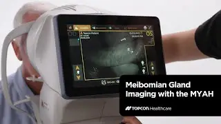 Imaging the Meibomian Glands using the Topcon MYAH