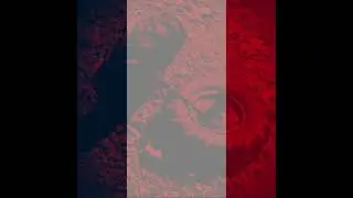 French. - HYPERAKUSIS