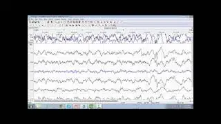 26. RemLogic Spectral Analysis