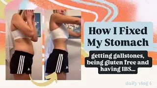 Healing My Gut - getting my gallbladder removed at 17, being gluten free and having IBS