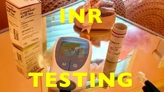 FULL VIDEO: HOW TO Check Your INR At Home Roche CoaguChek - Blood Clot Thinner Coumadin INR Test