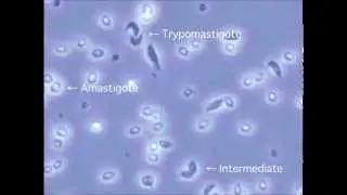 A Novel Method for Inducing Amastigote-To-Trypomastigote Transformation In Vitro in Trypanosoma...