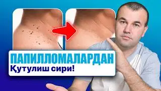 Папилломадан қандай қутулиш мумкин? Дерматолог тушунтиради