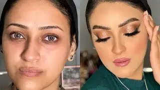 جزء مهم لشرح مسام البشره المختلطه 👌🫶🏻