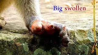 Janet's hands got big swollen | Janet hard to eat cos her hand still in hurting