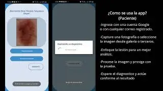 APP_Melanoma