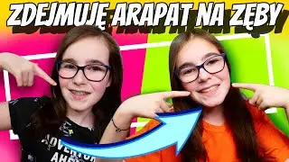 ZDEJMUJĘ APARAT NA ZĘBY. Jak teraz wyglądam? #fikimikiagatkiimoniki