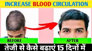 How To Increase Blood Circulation On Scalp For Hair Growth | बिना Minoxidil और Derma Roller के