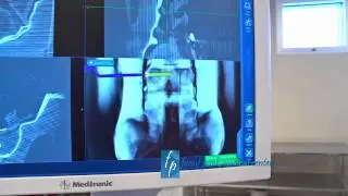 Chris Uphues Medtronic explains the O Arm at Forest Park MC
