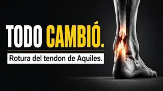 Mi VIDA CAMBIO después de romperme el TENDÓN DE AQUILES