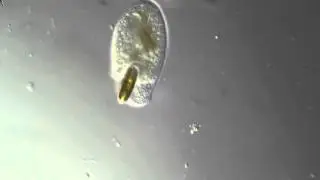 Trithigmostoma swallowing a diatom