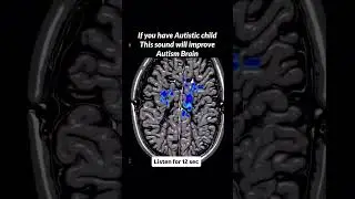432 Hz Golden Ratio Frequency for Autism & ADHD | Improve Brain Function & Focus
