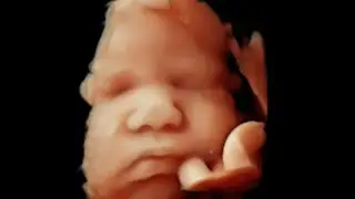 Kerry & Gareth 4D 5D baby scan 34 weeks & 5 days 