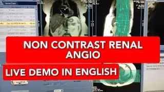 MRI Renal Angiography protocol, positioning and planning | Live Demo in English.