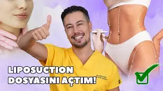 Liposuction Dosyasını Açtım! 📁
