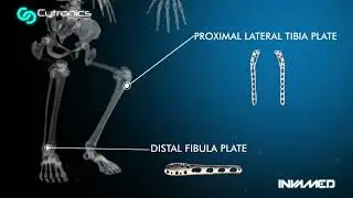 Invamed Cytronics&reg; Orthopedic Surgical Products