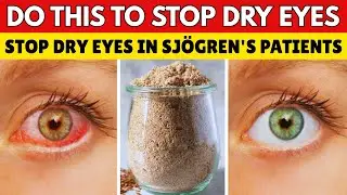 Sj&ouml;gren's Patients: 8 NATURAL Remedies To END Your Dry Eye Symptoms!