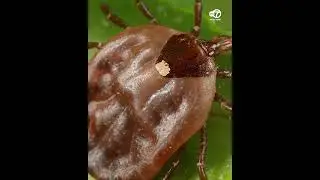 What to know after NJ man 1st confirmed death linked to a meat allergy spread by ticks