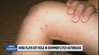Wind plays key role in Swimmer&rsquo;s itch outbreaks