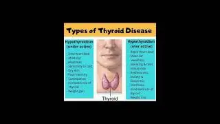 Types of Thyroid Diseases