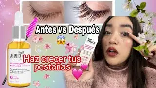 💖AND COSMETICS: SUERO de PESTAÑAS y CEJAS! MI EXPERIENCIA USÁNDOLO POR 1 MES! 😱 QUEDÉ SORPRENDIDA 😯