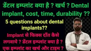 डेंटल इम्प्लांट क्या है ? खर्च ? Dental implant, cost, time, durability ??