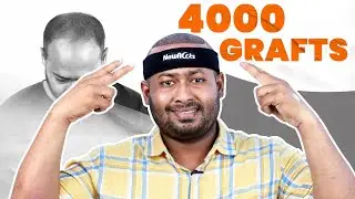 Patient Experience: Best Hair Transplant Clinic in Bangladesh 😉 | New Roots