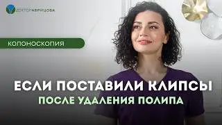 Поставили клипсы после колоноскопии — что со мной теперь будет?