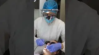 how I clean my patients' teeth with braces #shorts