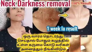 Neck darkness removal at home/ home remedies for neck darkness removal/ gayus lifestyle