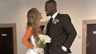 Wie viel kostet ein Zahn bleaching?🤯