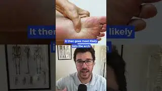 Possible reasons for your heel pain
