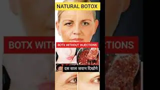 botox treatment for face | botox without injections #shorts #youtubeshorts #botox #botoxnatural