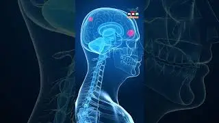 Early Detection Saves Lives | Brain Tumour Awareness with Dr. Abhilash Gajjala