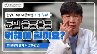 눈밑지방재배치? 지방제거? 하안검? 눈밑이 튀어나왔다면 뭘 해야 할까요?