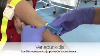 Troponin Test
