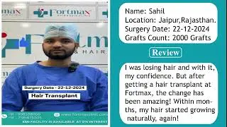 Real Results, Real Stories #hairtransplant Journey | Fortmax clinics Jaipur #haircare #hair #doctor