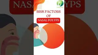 Unbelievable Risk Factors of Nasal Polyps #shorts #anavara #vkare