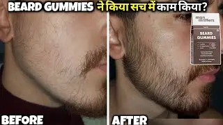 Man matters beard gummies का सच देखलो आज | minoxidil beard growth | man matters beard gummies review