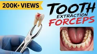 Tooth Extraction Forceps