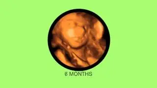 Non-Diagnostic 3D/4D Ultrasound