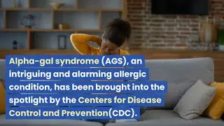 AGS: The Tick-Triggered Meat Allergy Impacting a Significant Number of Individuals